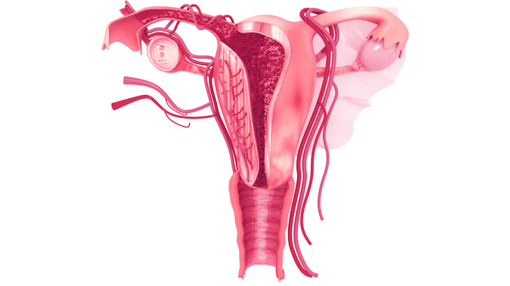 Diagnosing and Treating Asherman&rsquo;s Syndrome