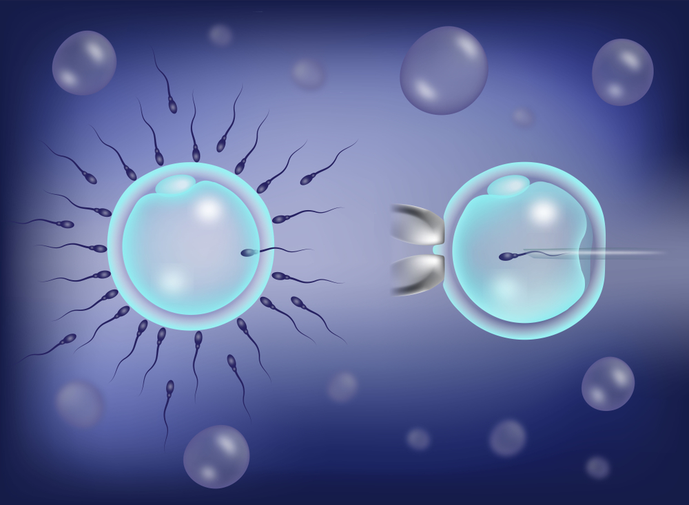 IUI vs. IVF: What's the Difference?