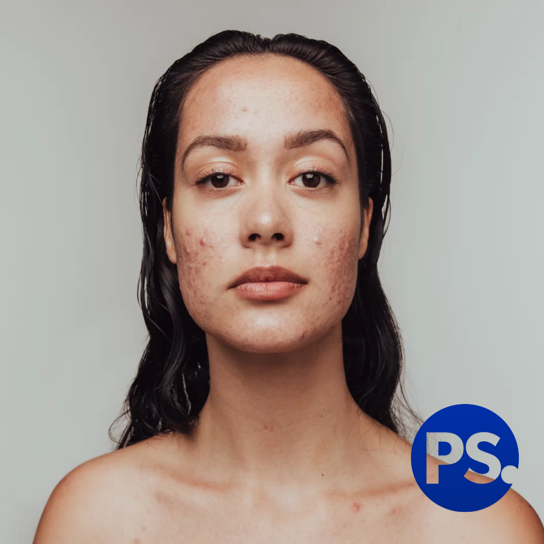 Is There Any Merit Behind TikTok's "Cortisol Face" Obsession?