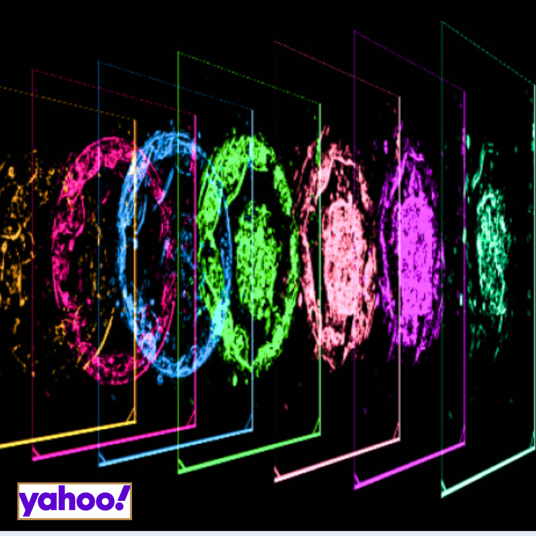 Study shows potential of AI model in improving ovarian stimulation decisions in IVF treatment